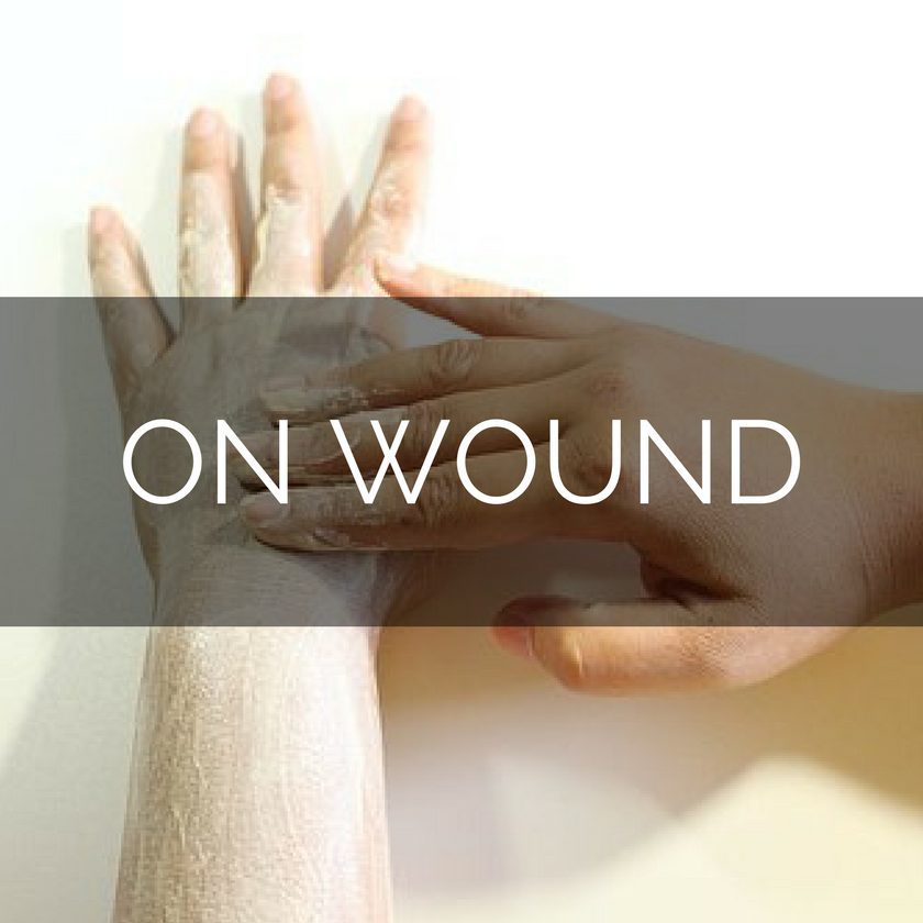 ON WOUND